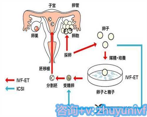 供卵机构可靠吗,日本单身男性试管：从咨询到成功，每一步都至关重要